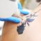 laserowe usuwanie tatuazu