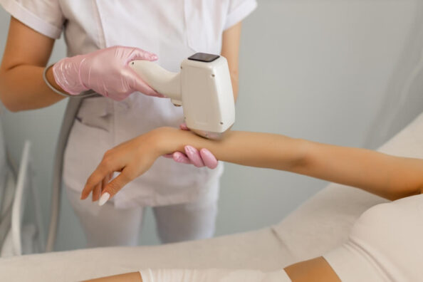 shutterstock_2646791445 depilacja laserowa