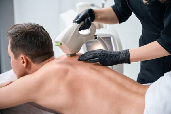 depilacja laserowa mezczyzn (1) depilacja laserowa mezczyzn